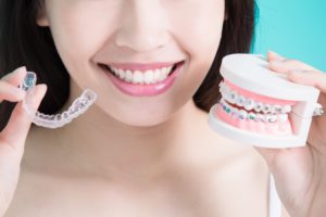 braces vs aligners