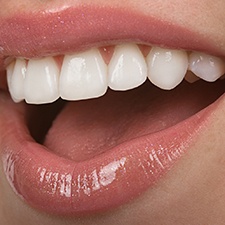 Closeup of a smile that received cosmetic dentistry in Waco