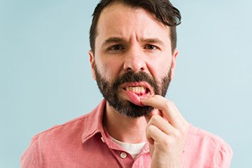 A young, bearded man suffering from gingivitis