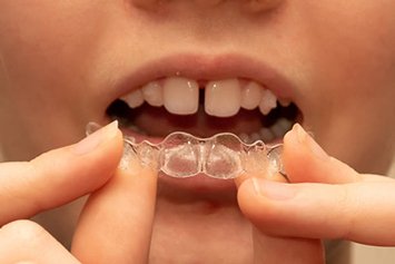 Close up of woman with gapped front teeth