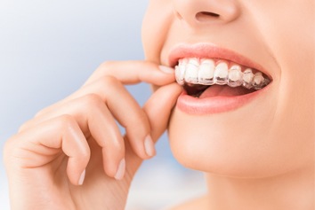 woman inserting Invisalign trays 