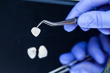 A dentist holding a veneer with a tweezer